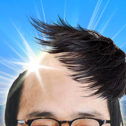 秃头接头发